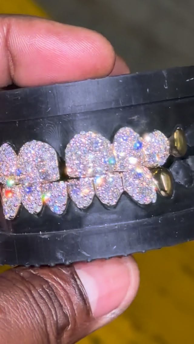 SPLIT GAP — JR Da Jeweler custom grillz
