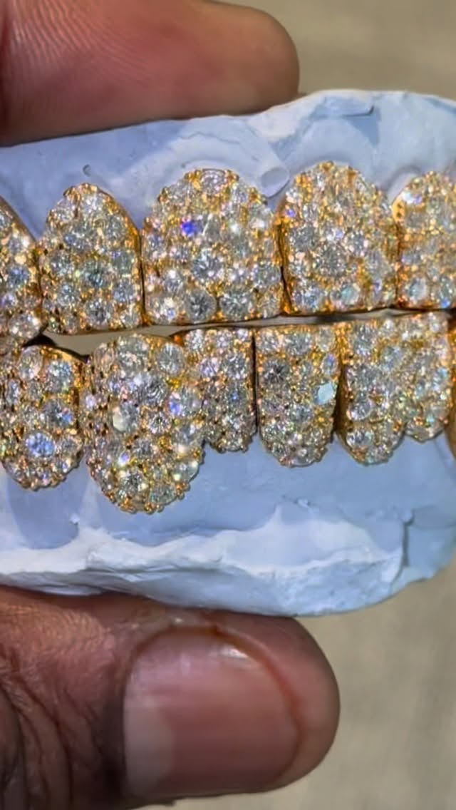 THE MOSAIC — JR Da Jeweler custom grillz