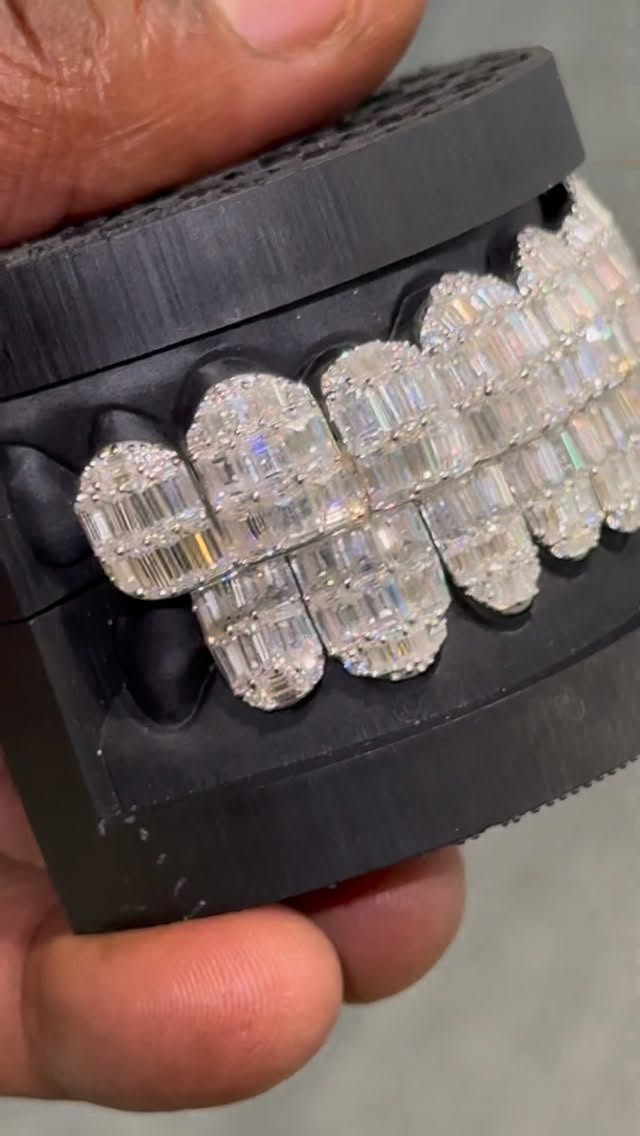 JR diamond grillz